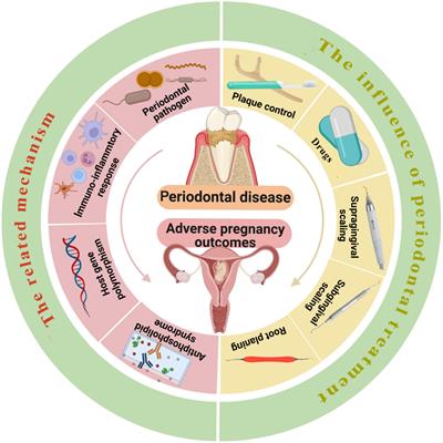 Periodontal disease in pregnancy and adverse pregnancy outcomes: Progress in related mechanisms and management strategies